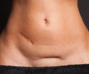 Ohne Mütze kriegt man eine Erkältung, heißt es.